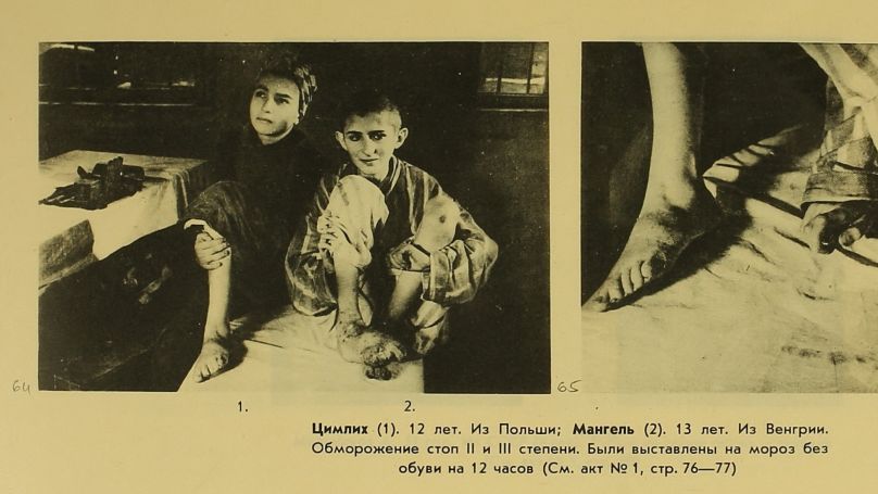 Teenage boys at Auschwitz with frostbite on their feet
